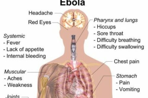 Article : L’épidémie du virus Ebola est loin d’être finie en RDC